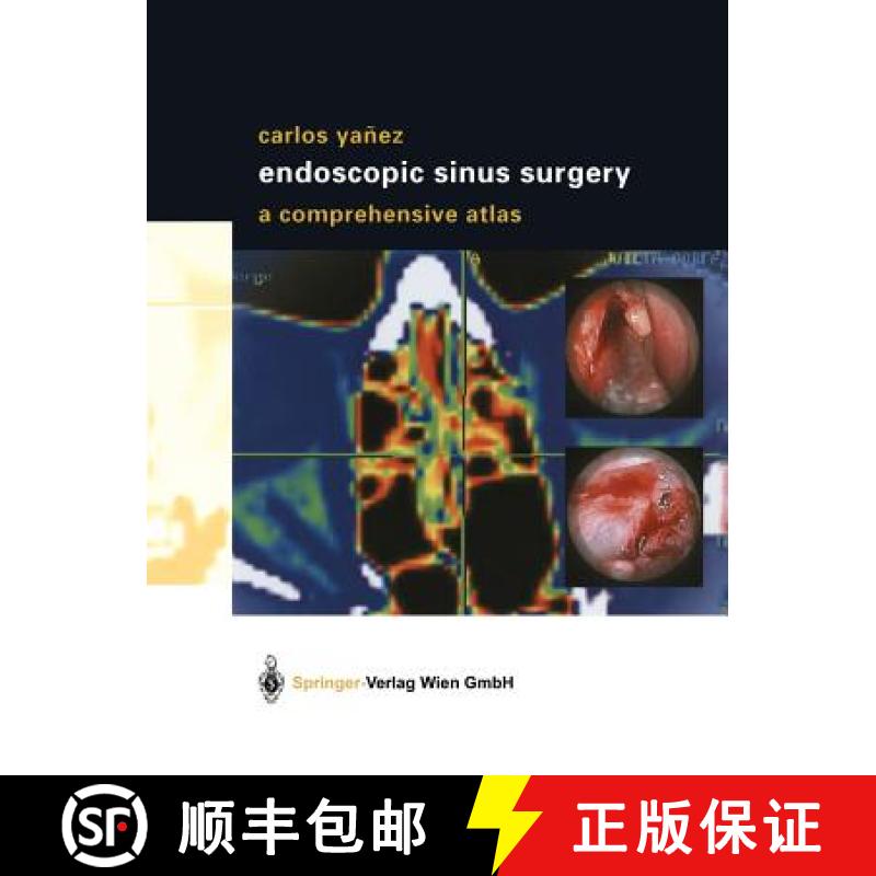 【3-4周达】Endoscopic Sinus Surgery: A Comprehensive Atlas [9783709172797]