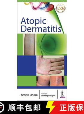 【3-4周达】Atopic Dermatitis [9789352702275]