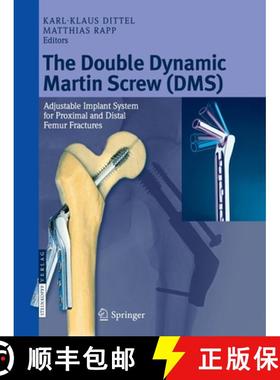 【3-4周达】The Double Dynamic Martin Screw (DMS) : Adjustable Implant System for Proximal and Distal ... [9783662526880]