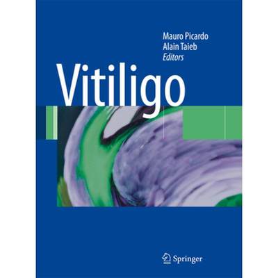 【4周达】Vitiligo [9783642422744]