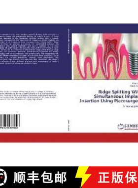 预订 Ridge Splitting With Simultaneous Implant Insertion Using Piezosurgery [9783659937040]