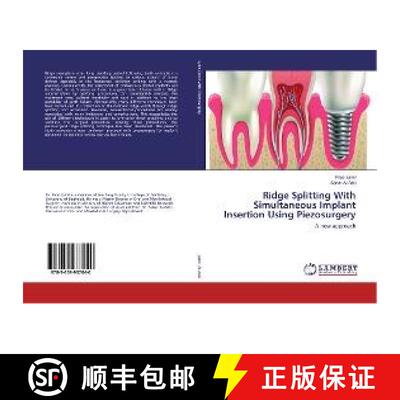 预订 Ridge Splitting With Simultaneous Implant Insertion Using Piezosurgery [9783659937040]