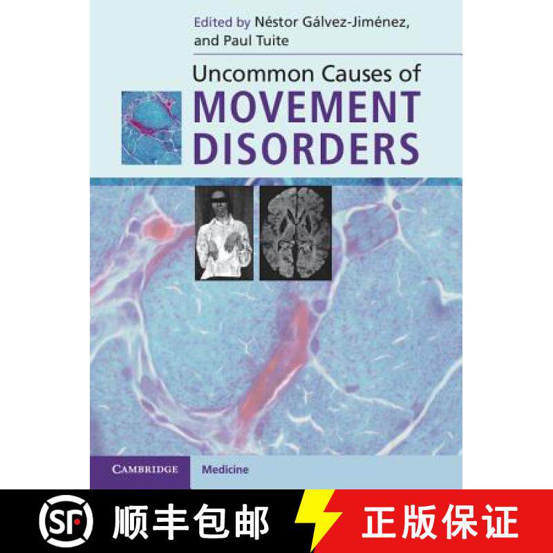 现货 Uncommon Causes of Movement Disorders [9780521111546]