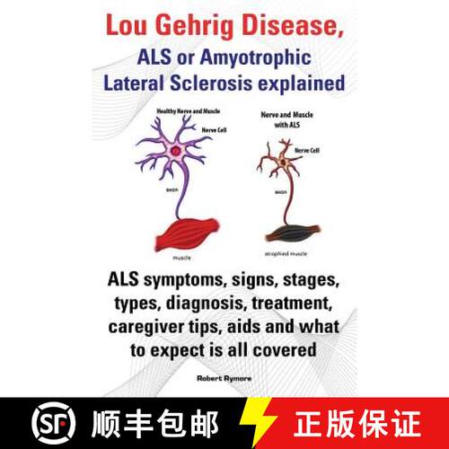 【3-4周达】Lou Gehrig Disease, ALS or Amyotrophic Lateral Sclerosis explained. ALS symptoms, signs, s... [9781909151604]