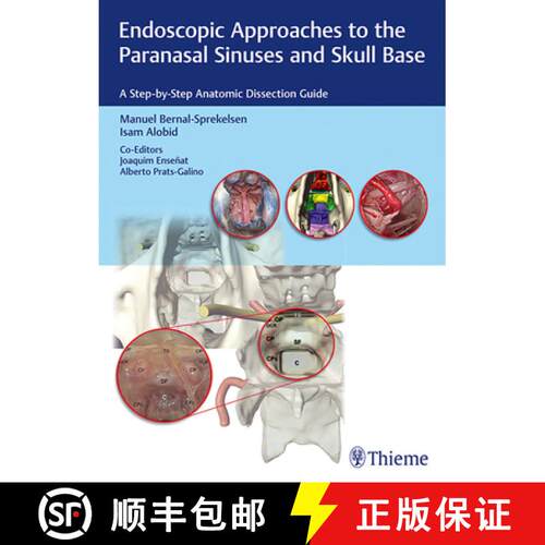 【3-4周达】精装 Endoscopic Approaches to the Paranasal Sinuses and Skull Base: A Step-By-Step Anatomi... [9783132018815]
