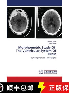 预订 Morphometric Study Of The Ventricular System Of Brain [9786202518109]