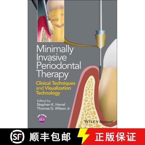 【3-4周达】Minimally Invasive Periodontal Therapy: Clinical Techniques And Visualization Technology [... [9781118607626]