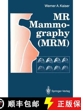 【3-4周达】MR Mammography (MRM) [9783642772580]