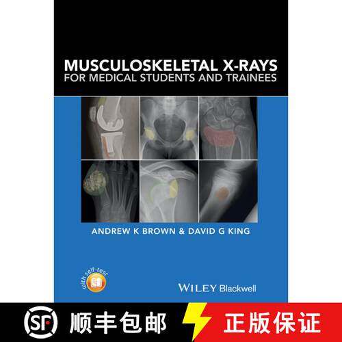 【3-4周达】Musculoskeletal X-Rays For Medical Students [Wiley医学] [9781118458730]