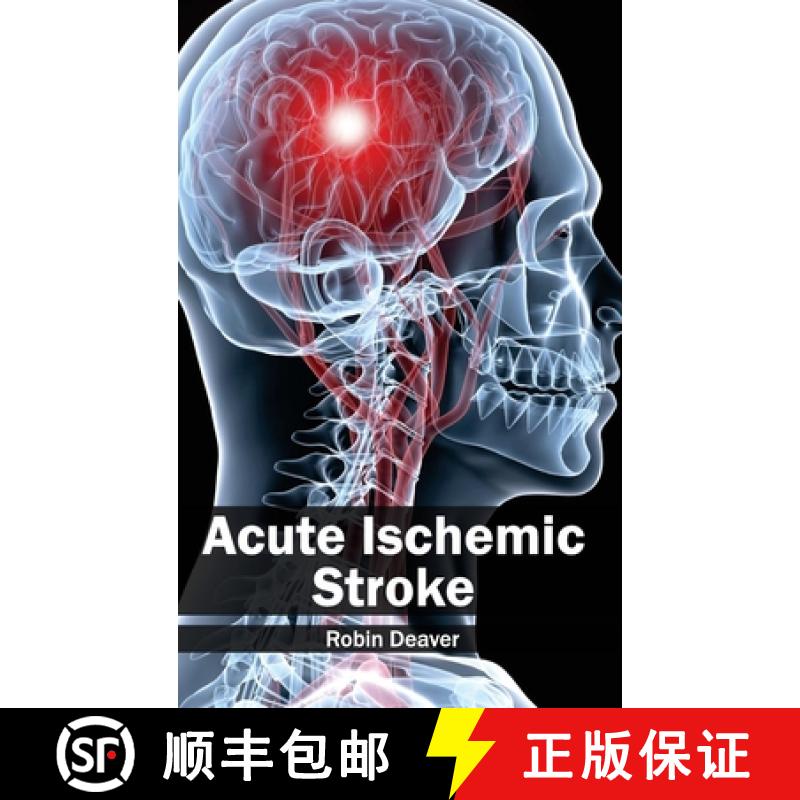 【3-4周达】Acute Ischemic Stroke [9781632410078]