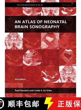 【3-4周达】An Atlas Of Neonatal Brain Sonography - Clinics Indevelopmental Medicine [Wiley医学] [9781898683568]