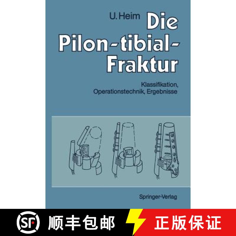 【3-4周达】Die Pilon-Tibial-Fraktur: Klassifikation, Operationstechnik, Ergebnisse [9783642759604]