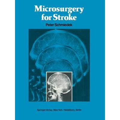 【4周达】Microsurgery for Stroke [9781461263517]