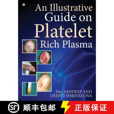 现货 An Illustrative Guide on Platelet Rich Plasma [9781646786114]