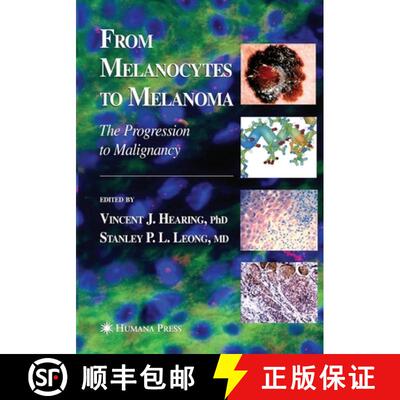 【3-4周达】From Melanocytes to Melanoma : The Progression to Malignancy (Softcover reprint of the ori... [9781493956746]