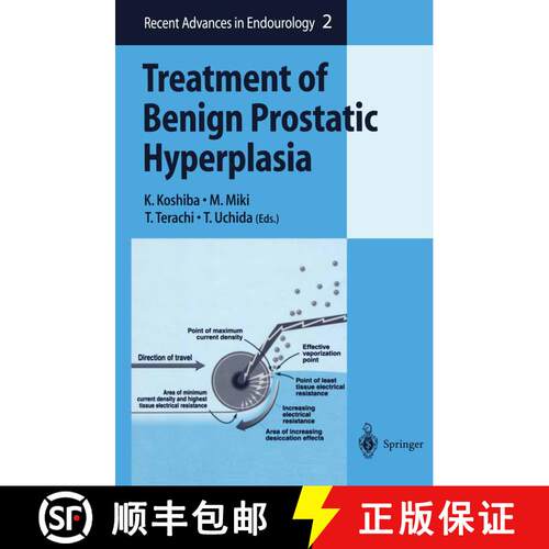 【3-4周达】精装 Treatment of Benign Prostatic Hyperplasia [9784431702849]