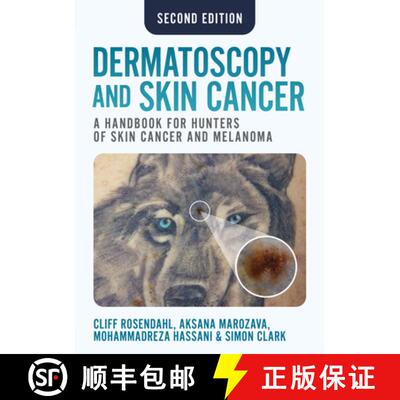 【3-4周达】Dermatoscopy and Skin Cancer, second edition : A handbook for hunters of skin cancer and m... [9781914961670]