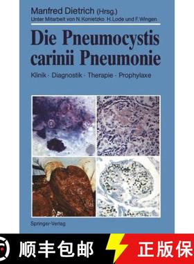 【3-4周达】Die Pneumocystis Carinii Pneumonie: Klinik - Diagnostik - Therapie - Prophylaxe [9783540511779]