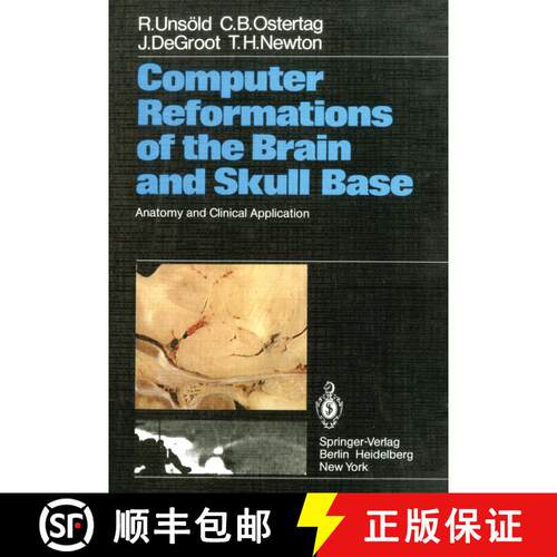 【3-4周达】Computer Reformations of the Brain and Skull Base: Anatomy and Clinical Application [9783642685989]