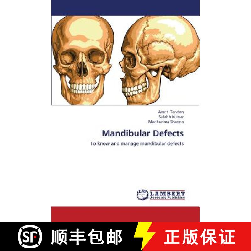 预订 Mandibular Defects [9783659396472]