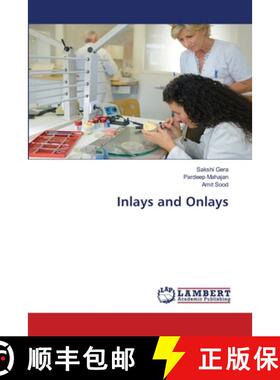 【3-4周达】Inlays and Onlays [9786207462735]
