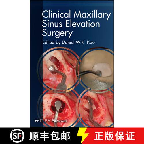 【3-4周达】Clinical Maxillary Sinus Elevation Surgery [Wiley牙科医学] [9780470960738]