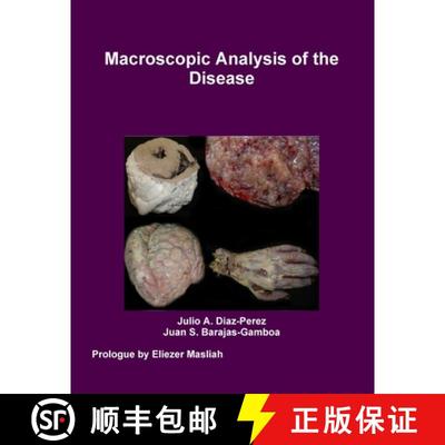 【2-3周达】Macroscopic Analysis of the Disease [9781105519932]