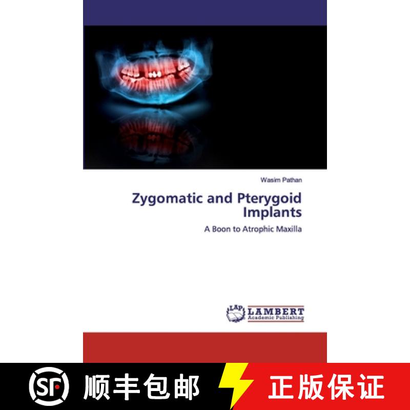 【3-4周达】Zygomatic and Pterygoid Implants [9783659695292]