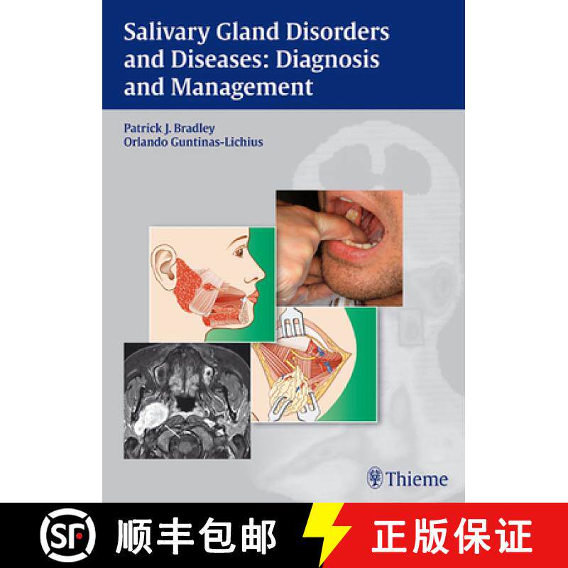 【3-4周达】精装 Salivary Gland Disorders and Diseases:: Diagnosis and Management [9783131464910] - 实物图
