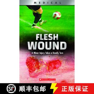 Flesh 9780531132968 XBooks Takes 3周达 Wound Turn Minor Deadly Injury