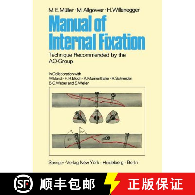 【3-4周达】Manual of Internal Fixation: Technique Recommended by the Ao-Group Swiss Association for t... [9783642960673]
