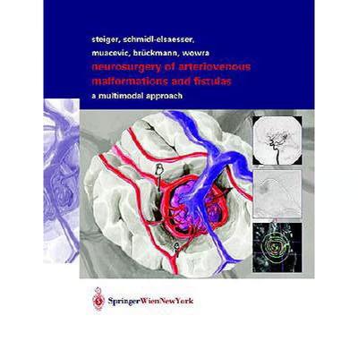 【4周达】Neurosurgery of Arteriovenous Malformations and Fistulas: A Multimodal Approach [9783211837030]