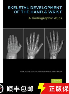 【3-4周达】Skeletal Development of the Hand & Wrist: A Radiographic Atlas & Digital Bone Age Companio... [9780199782055]