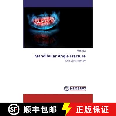 预订 Mandibular Angle Fracture [9786139471881]