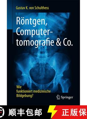 【3-4周达】Röntgen, Computertomografie & Co. : Wie funktioniert medizinische Bildgebung? [9783662539309]