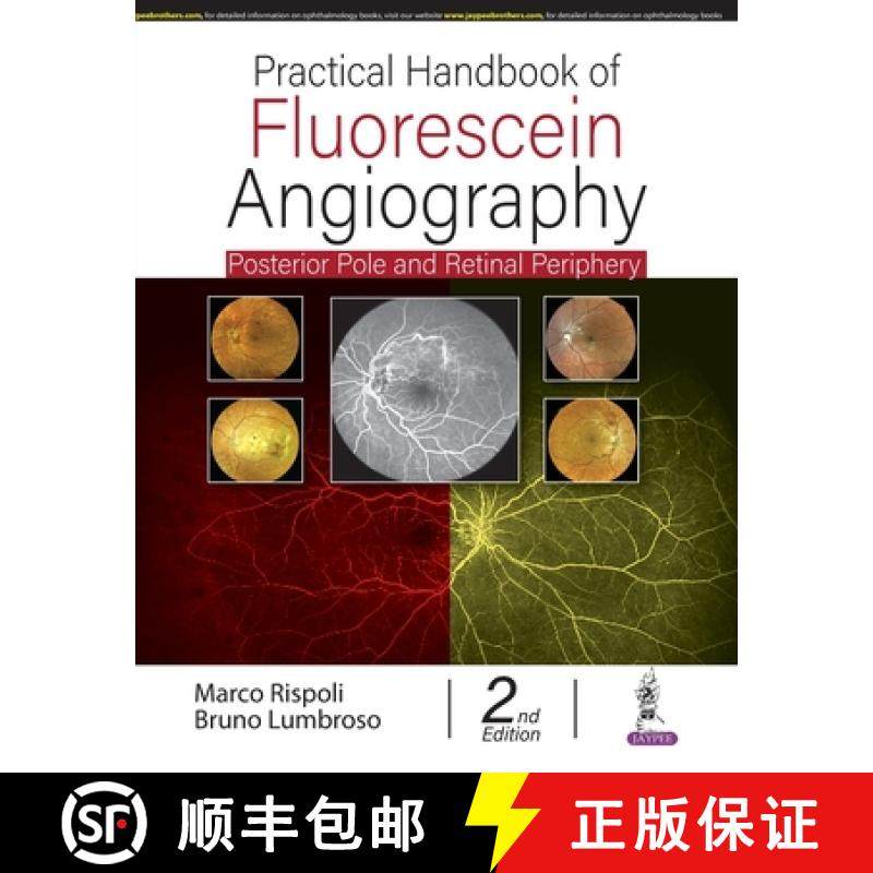 【3-4周达】Practical Handbook of Fluorescein Angiography : Posterior Pole and Retinal Periphery [9789354657894]