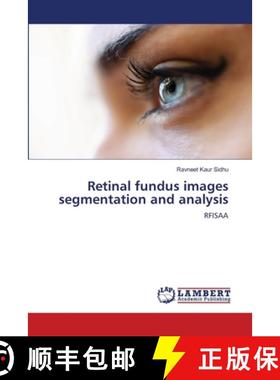【3-4周达】Retinal fundus images segmentation and analysis [9786206157991]