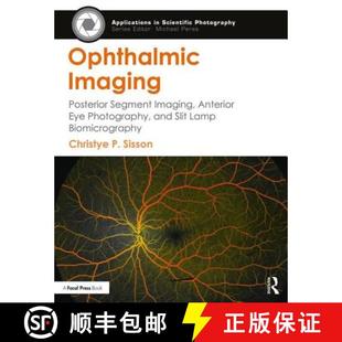 Imaging Anterior Ophthalmic Lamp 9781138886001 Slit Posterior 4周达 Photography Eye Segment Bio... and