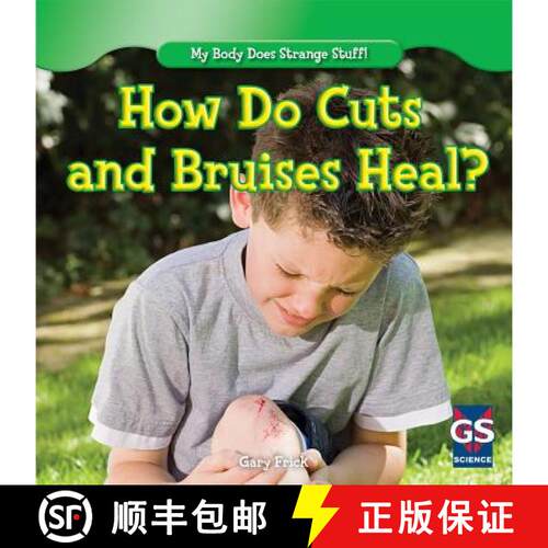 【3-4周达】精装 How Do Cuts and Bruises Heal? [9781482402346]
