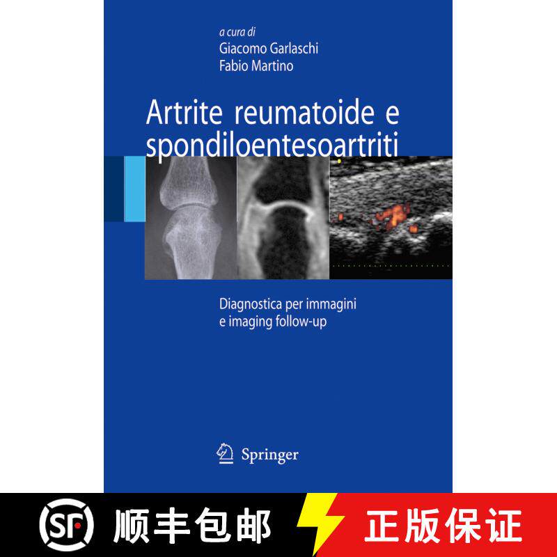 【3-4周达】精装 Artrite reumatoide e spondiloentesoartriti: Diagnostica per immagini ed imaging foll...[9788847006850]