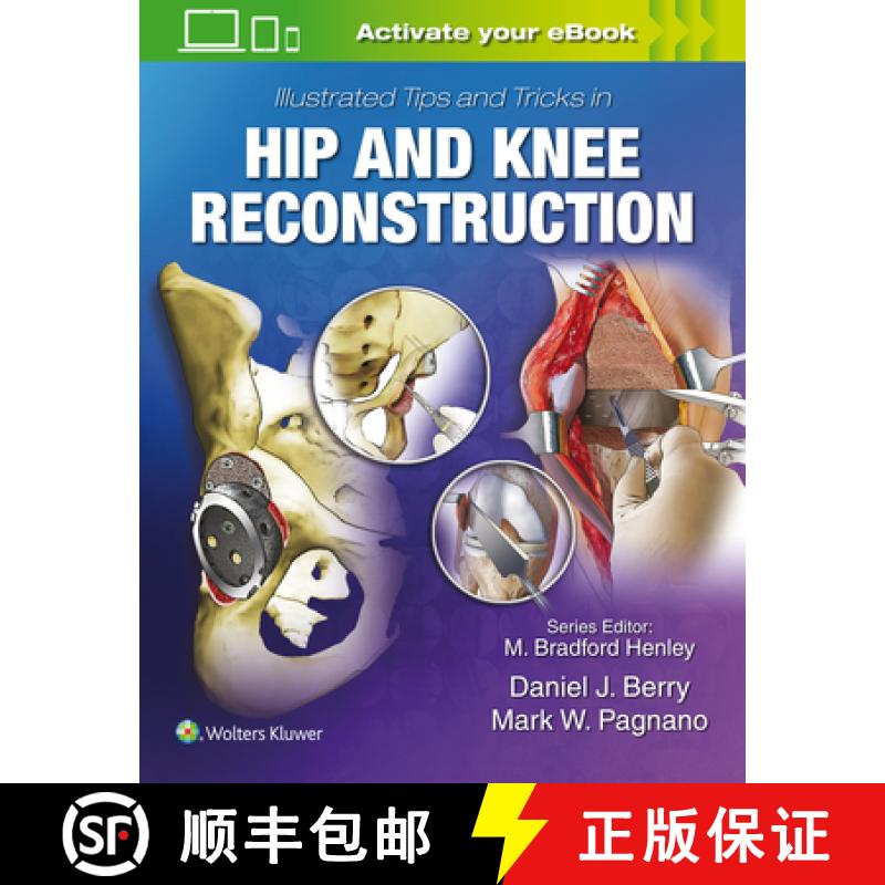 【2-3周达】Illustrated Tips and Tricks in Hip and Knee Reconstructive and Replacement Surgery [9781496392060]