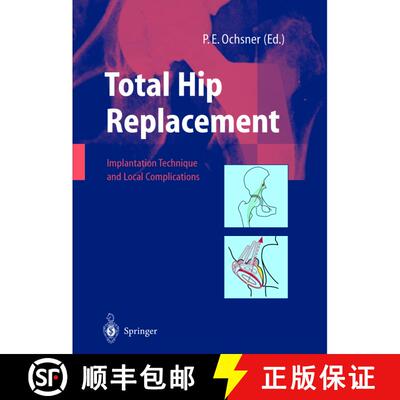 【3-4周达】精装 Total Hip Replacement: Implantation Technique and Local Complications [9783540438762]