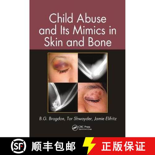 【3-4周达】Child Abuse and Its Mimics in Skin and Bone [9780367778187]