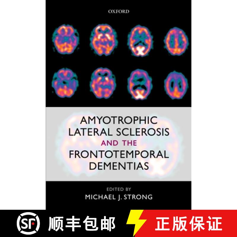 【3-4周达】Amyotrophic Lateral Sclerosis and the Frontotemporal Dementias [9780199590674]
