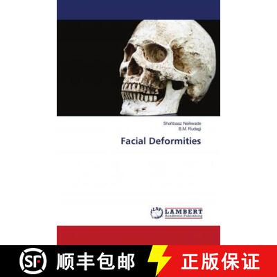 预订 Facial Deformities [9786202798365]
