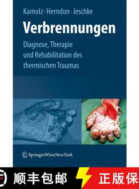 【3-4周达】Verbrennungen : Diagnose, Therapie und Rehabilitation des thermischen Traumas [9783211798959]