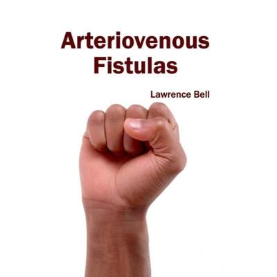 【4周达】Arteriovenous Fistulas [9781632410498]