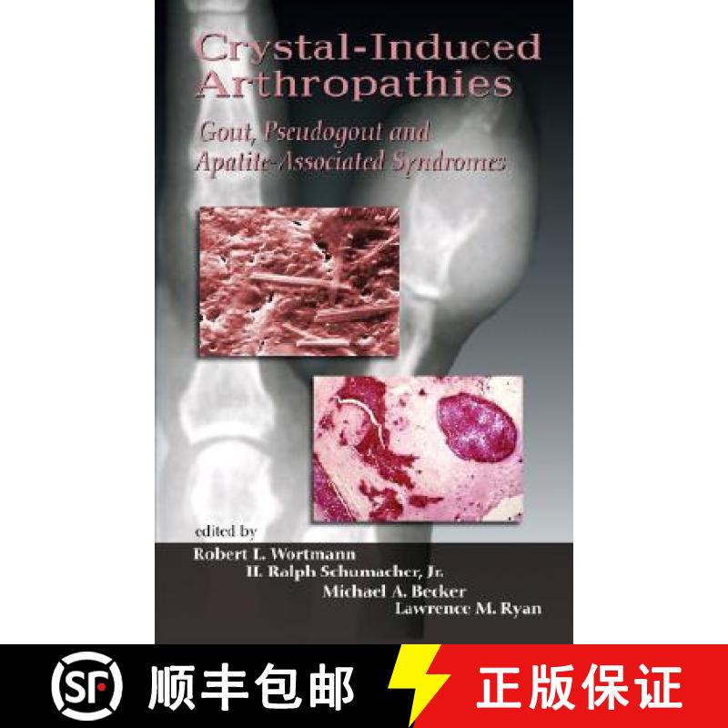 【3-4周达】Crystal-Induced Arthropathies : Gout, Pseudogout and Apatite-Associated Syndromes [9780849393822]
