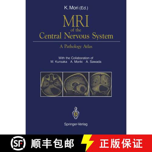 【3-4周达】MRI of the Central Nervous System : A Pathology Atlas [9784431681373]