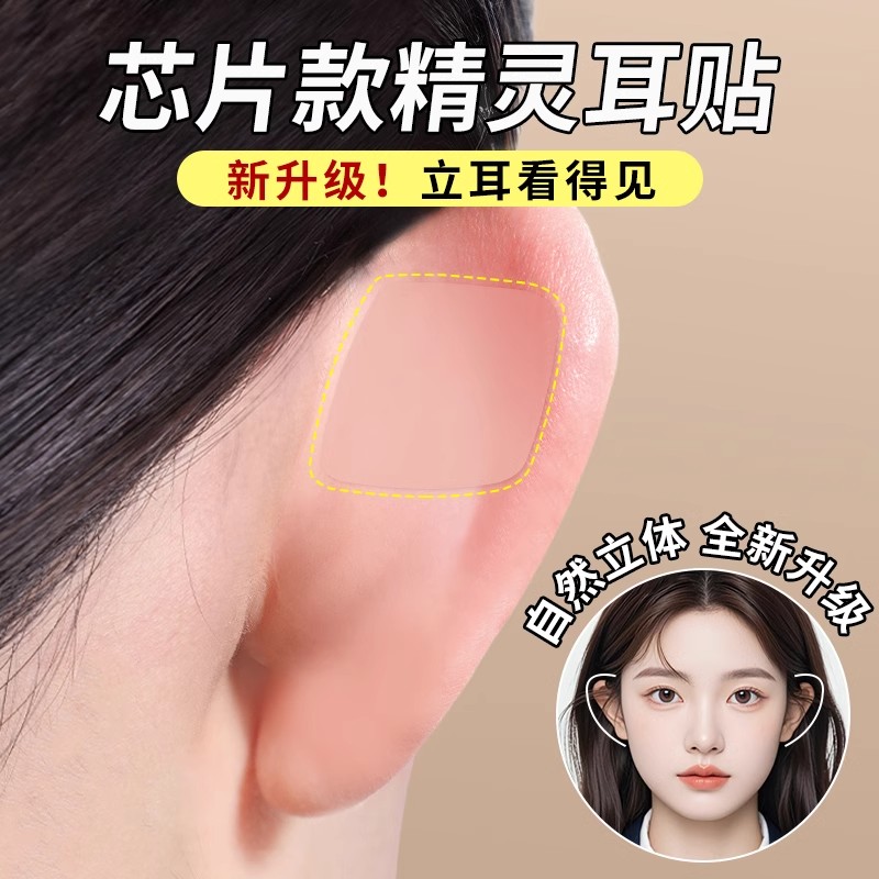 招风耳贴立防水定型矫正器